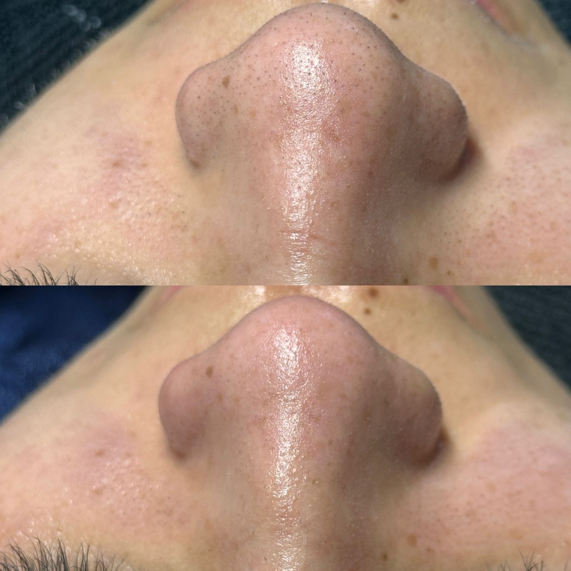 Higiene facial